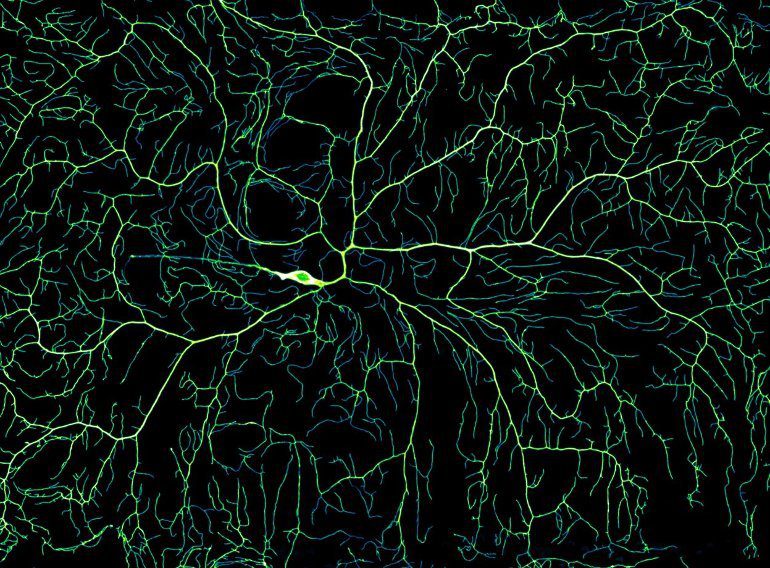 This shows a schematic diagram of branching dendrites